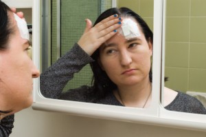 tbi image